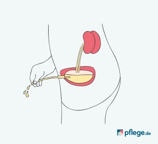 Kontinentes Urostoma Infografik