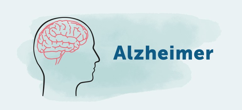 Alzheimer