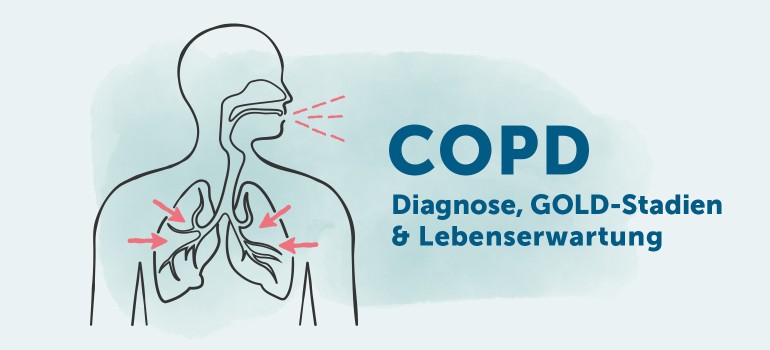 COPD Diagnose, Stadien, Lebenserwartung