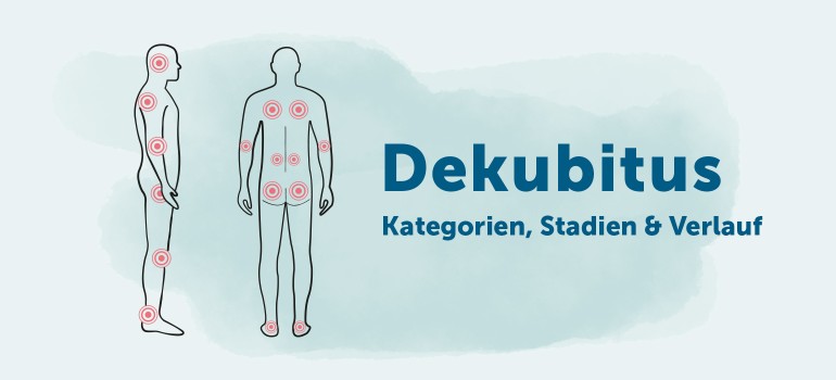 Dekubitus Kategorien, Stadien, Verlauf