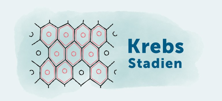 Krebsstadien: TNM-Klassifikation, Verlauf und Krebs im Endstadium