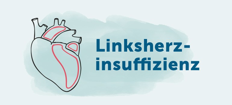 Linksherzinsuffizienz (Linksherzschwäche)