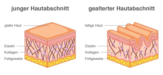 Bestandteile Trockene und juckende Haut Infografik
