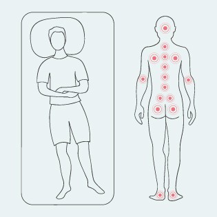 Prädilektionsstellen für Dekubitus in Rückenlage