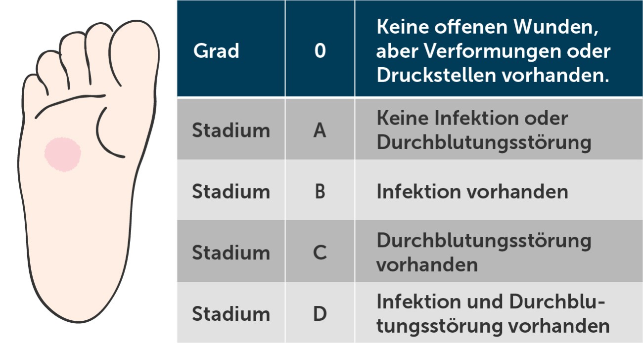 Diabetischer Fuß Wagner-Grad 0