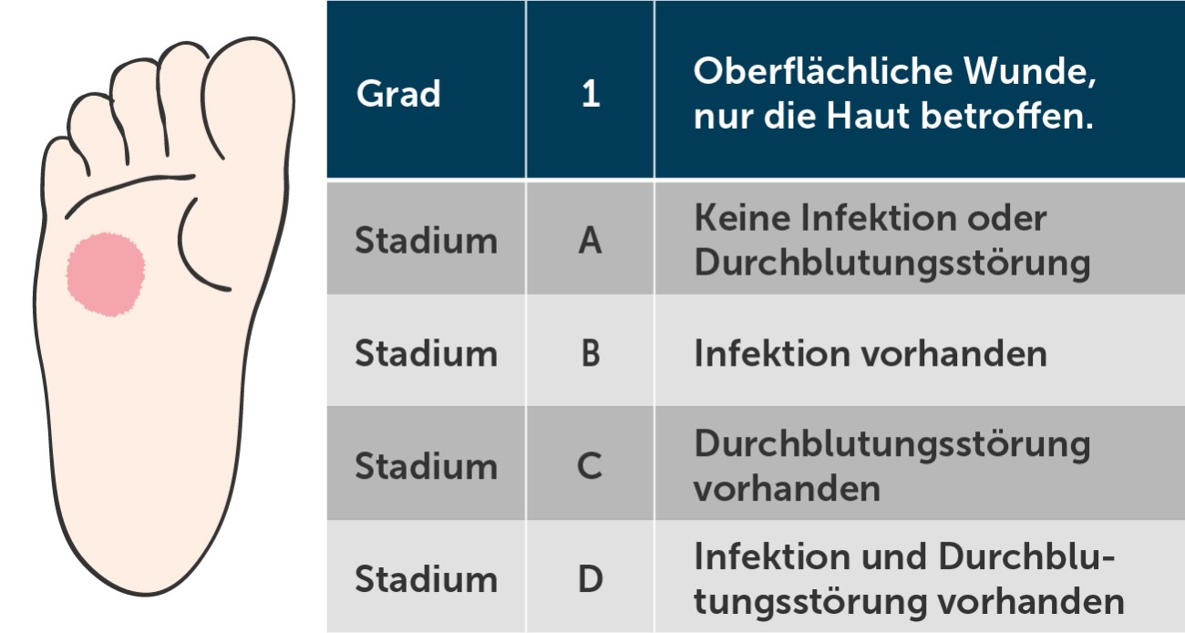 Diabetischer Fuß Wagner-Grad 1