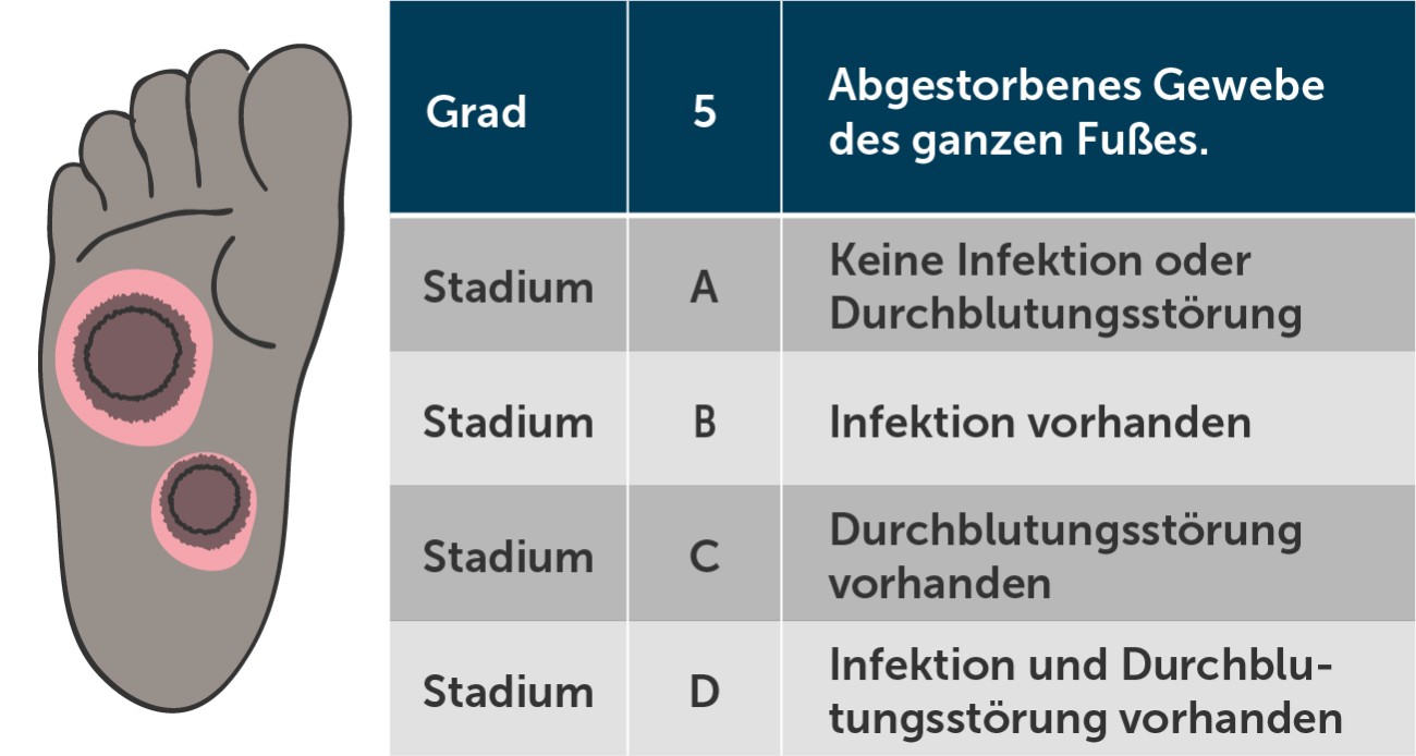Diabetischer Fuß Wagner-Grad 5
