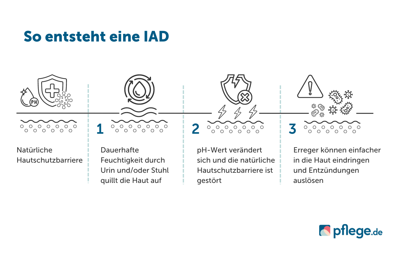 So entsteht eine IAD