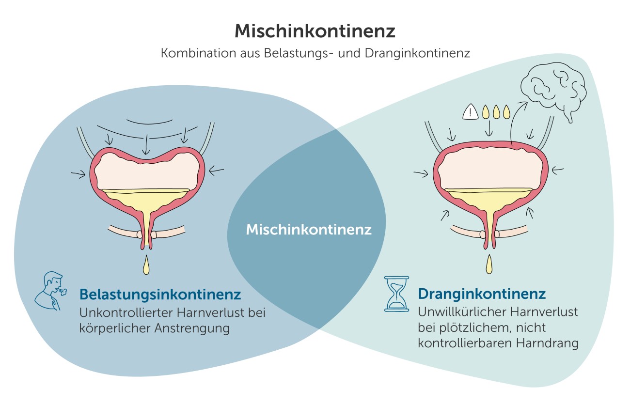 Mischinkontinenz