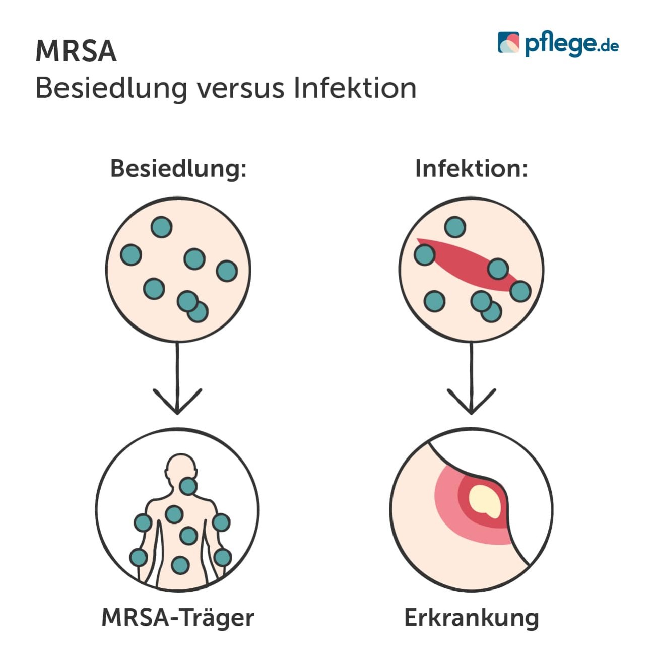 MRSA Besiedlung versus Infektion