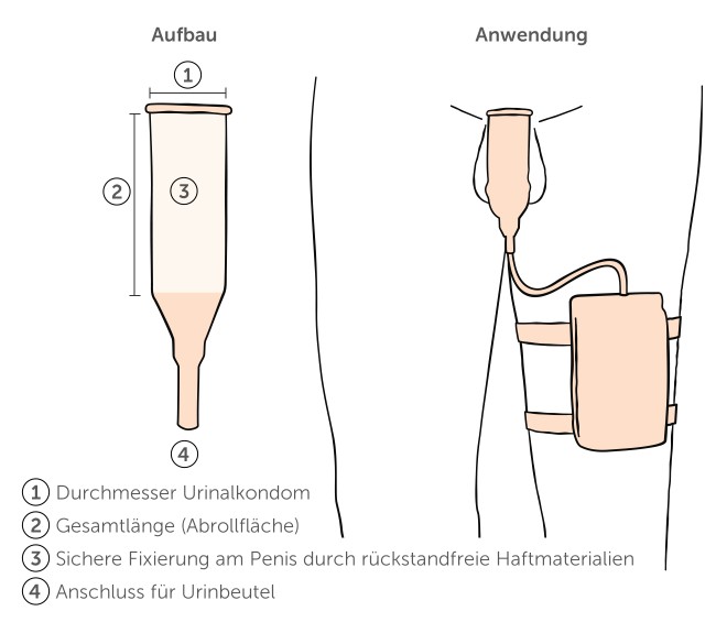 Aufbau und Anwendung Urinalkondom