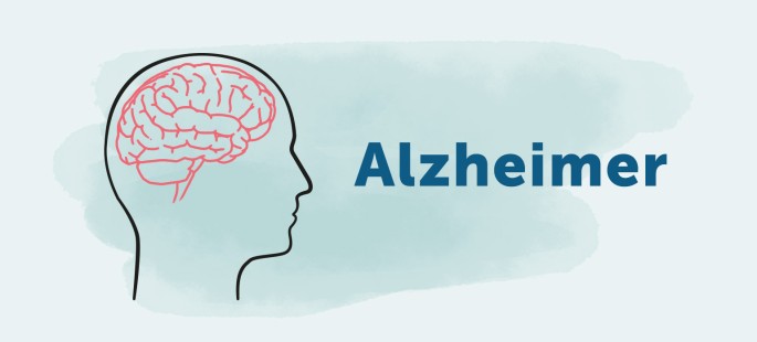 Alzheimer