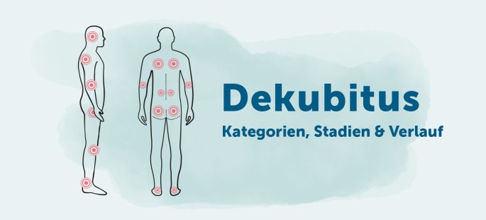Dekubitus Kategorien, Stadien, Verlauf